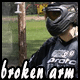broken arm's Avatar